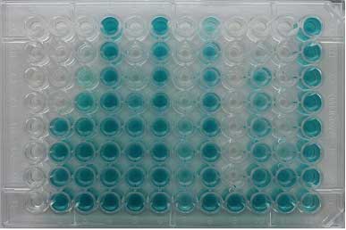 direct toxicity Toxi ChromoTest Platesmall