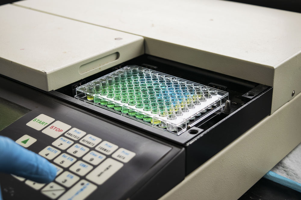 sos ChromoTest plate 4